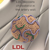 LDL Cholesterol (Image: American Heart Association)