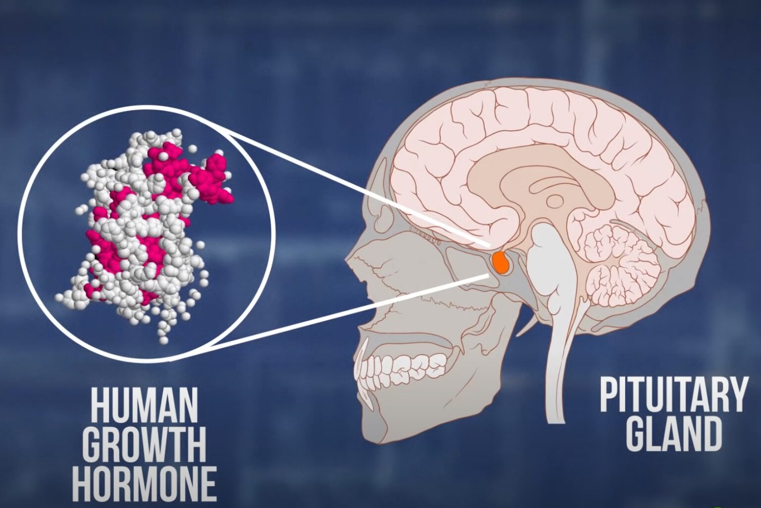 Catching Alzheimer's: News or Nonsense?