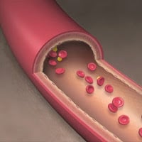 Blood flow in artery