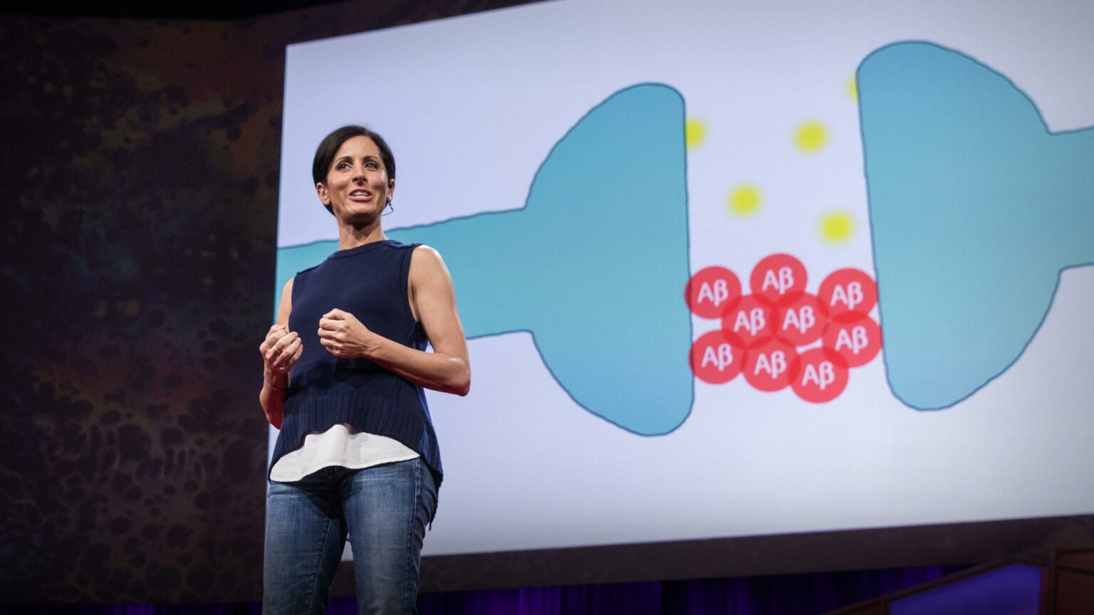 "Still Alice" Author: 7 Ways to Lower Your Alzheimer's Risk