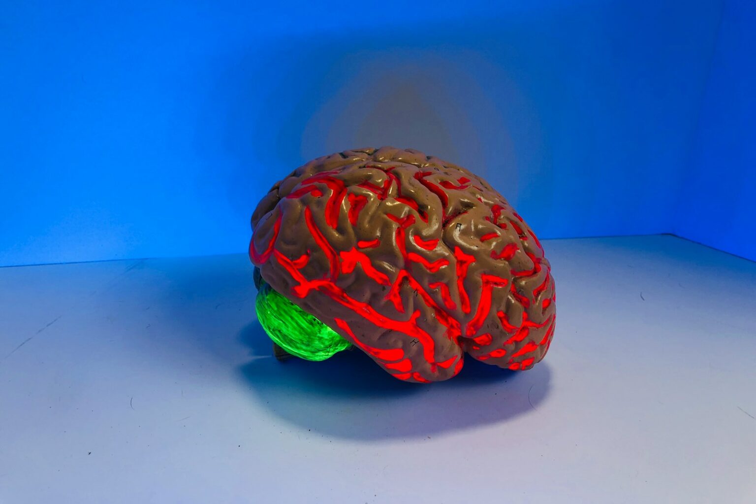 Blood Flow to the Brain Gets Blocked by Alzheimer's Plaque