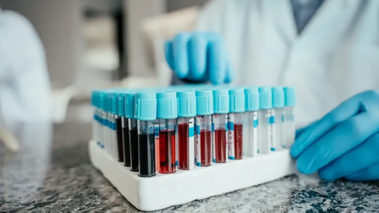Test tubes with p-tau217 blood tests