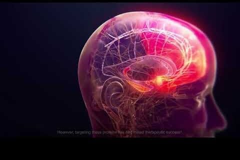 Alzheimer's Brain