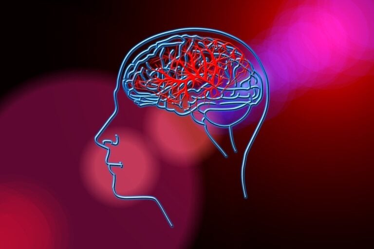 stroke, brain, blood circulation, anatomy, head, science, background, art, error, blood circulation disorder, neurons, stroke, stroke, stroke, stroke, stroke, blood circulation